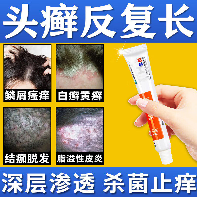 头癣药膏真菌感染头皮屑脂溢性皮炎治头部头癣银屑癣特效期硫软膏