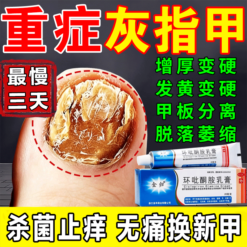 治疗灰指甲的非特效专用药膏水真菌感染旗舰店正品环吡酮胺乳膏