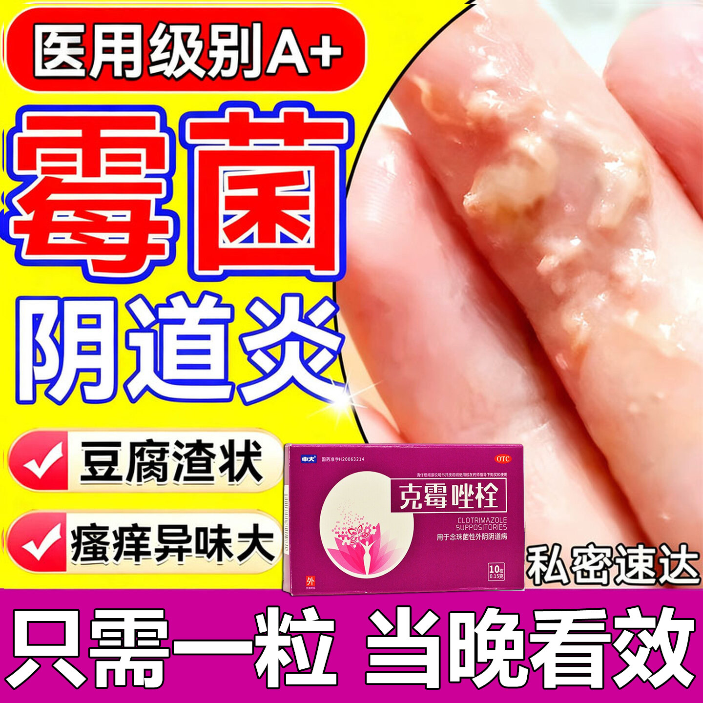 阴道炎妇科用药霉菌性给药治反复霉菌性阴道炎白带多豆腐渣