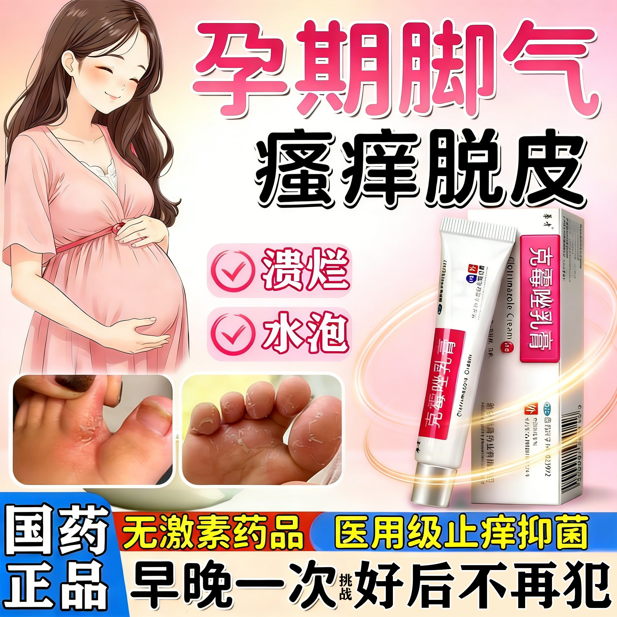 孕妇脚气止痒脱皮杀菌真菌感染专用哺乳期可用的药克霉唑乳膏正品