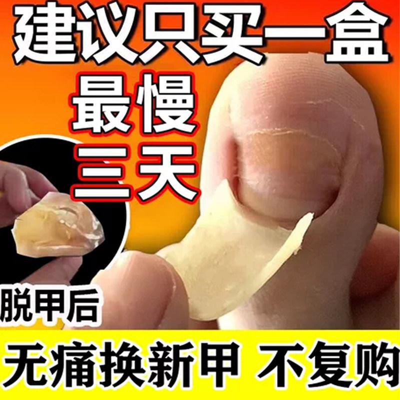 【金归】环吡酮胺乳膏1%*20g*1支/盒