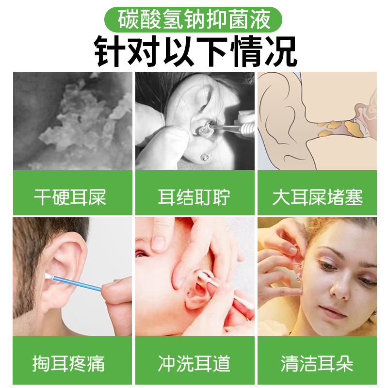 碳酸氢钠滴耳液人用洗耳水耵聍滴耳油儿童耳结石去耳垢耳屎软化剂
