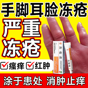 冻疮膏正品止痒冻伤膏耳朵脸部手指冻伤消肿防冻裂正品冬天冻伤S