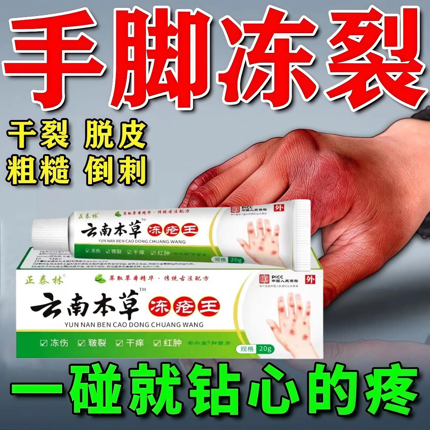 云南本草冻疮膏止痒冻伤膏药正品官方旗舰店儿童防冻裂耳朵手足X1