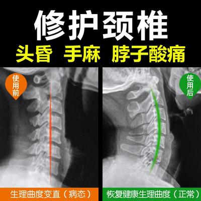颈椎枕头睡觉专用修护劲椎护颈病人荞麦助睡眠家用艾草组合圆枕硬