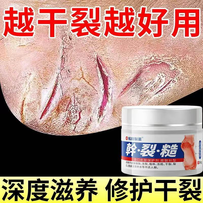 日本脚后跟干裂修复霜手足龟裂开裂皲裂养护缓解死皮润马油皱裂膏