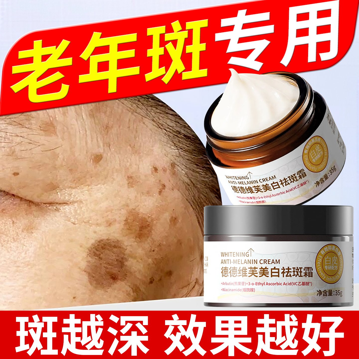 老年斑强力去除手部脸部去斑专用老人祛斑霜祛黄褐斑雀斑官方正品