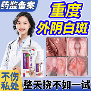 外阴白斑专用药膏止痒萎缩瘙痒非去女私处有小疙瘩毛囊炎根喷剂HX
