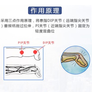 锤状手指套保护骨折固定器矫正护托肌腱损伤硬支撑定型支架