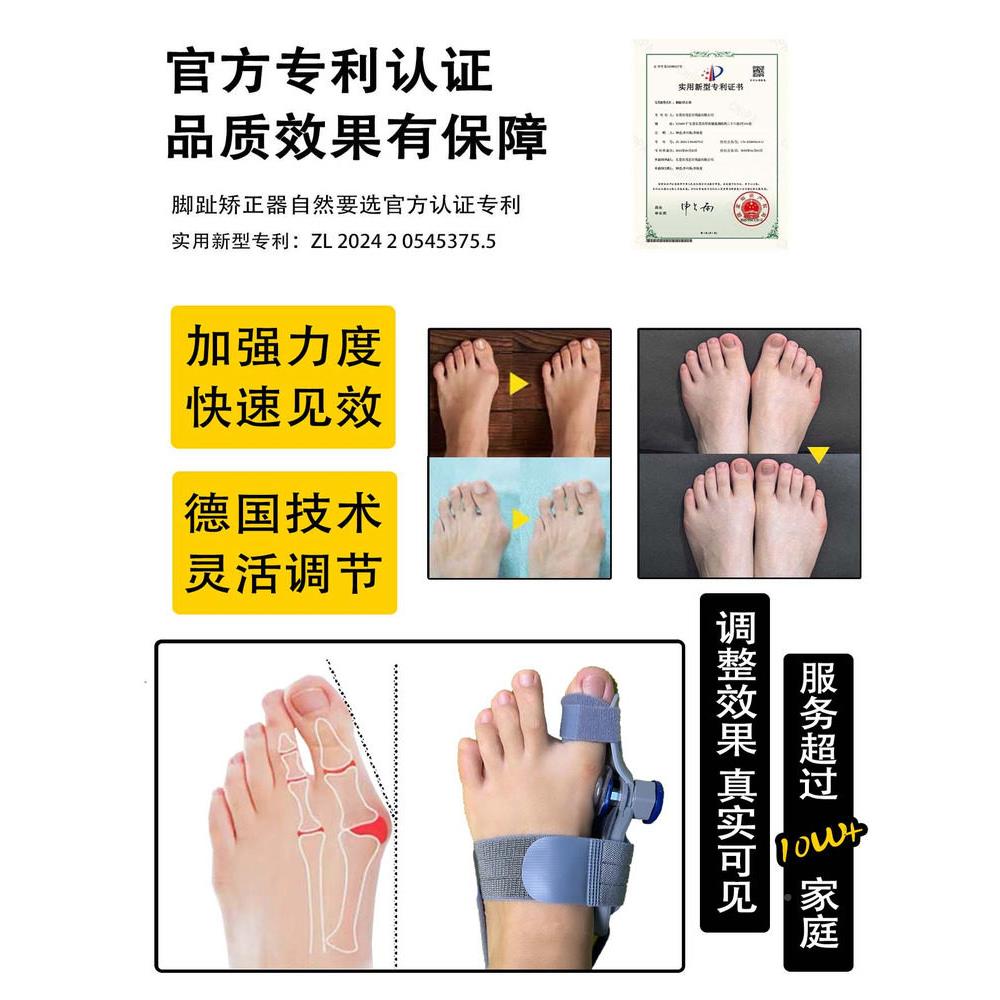 叠旋钮调节大拇指外正翻矫器大脚骨脚足突出分离男器829女士重分