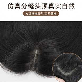 补发块女士头顶遮盖白发补发片扎针真人递针补发片仿真头皮真发女