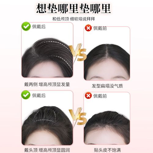 假发片女头顶补发蓬松增发量无痕隐形一片式高颅顶神器增发垫发片