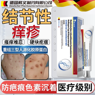 dr.avin结节性痒疹皮肤湿疹特效治顽固红硬疙瘩瘙痒止痒抑菌膏CS