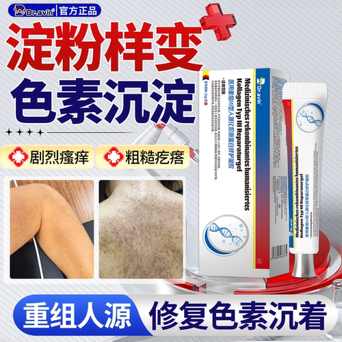 【皮肤淀粉样变】色素沉淀修复