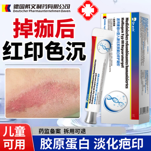 掉痂后红印修复擦伤摔伤疤痕除疤膏去黑色素沉淀医用去无痕祛疤QQ