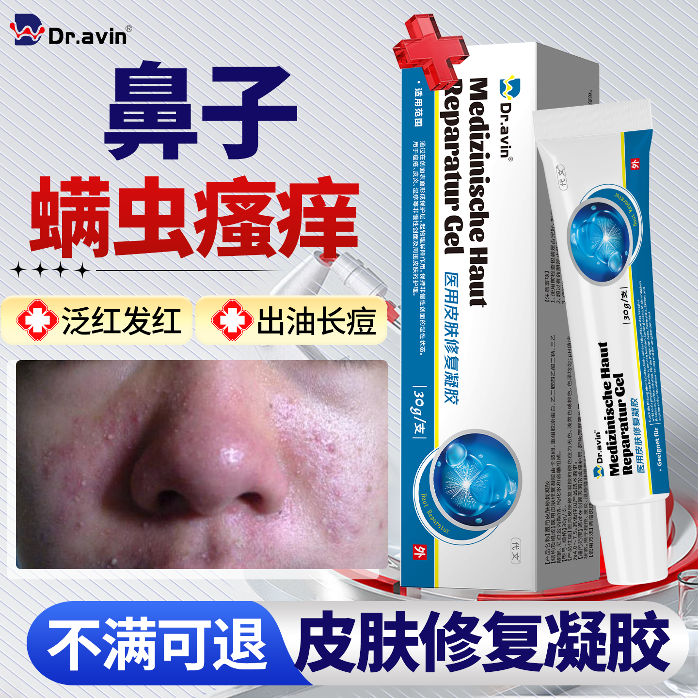 dravin螨虫膏祛痘面部脸上鼻子螨虫除螨克星脸部毛囊虫瘙痒药膏LJ