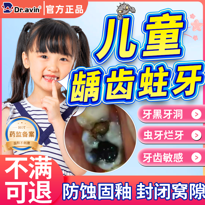 儿童龋齿蛀牙牙洞清理牙虫的膏药贴搭牙齿烂洞补牙牙釉质修复液CS