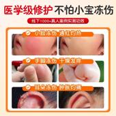 葵儿童冻疮膏冻花伤膏非止痒宝宝脸品部耳肿朵红防干裂官方XPZ正0