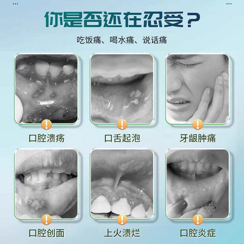 葵花口溃疡健康凝胶液嘴上巴火腔起泡生AQJ疮缓解疼痛修复黏膜喷