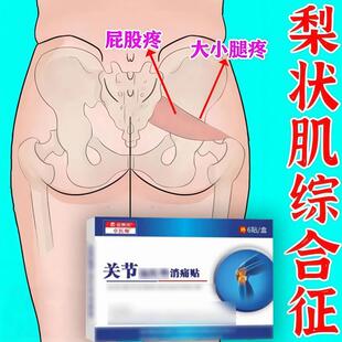 梨状肌综合症药特效腿屁股疼专用神器腰酸胀大小腿麻疼下肢疼困麻