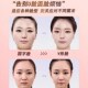 v脸绷带提拉紧致下垂提脸双下巴塑形面雕瘦脸绷带 2023爆卖