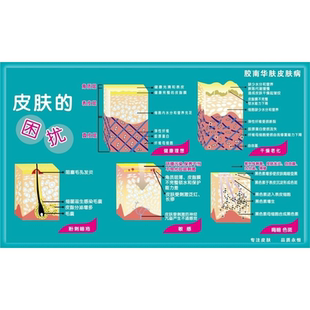 美容院皮肤解析图海报宣传画皮肤结构图贴画 美容院墙贴纸自粘画