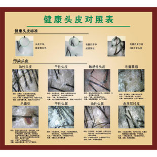 健康头皮对照表海报展板把根留住洗发露挂图无痕毛囊移植术墙贴