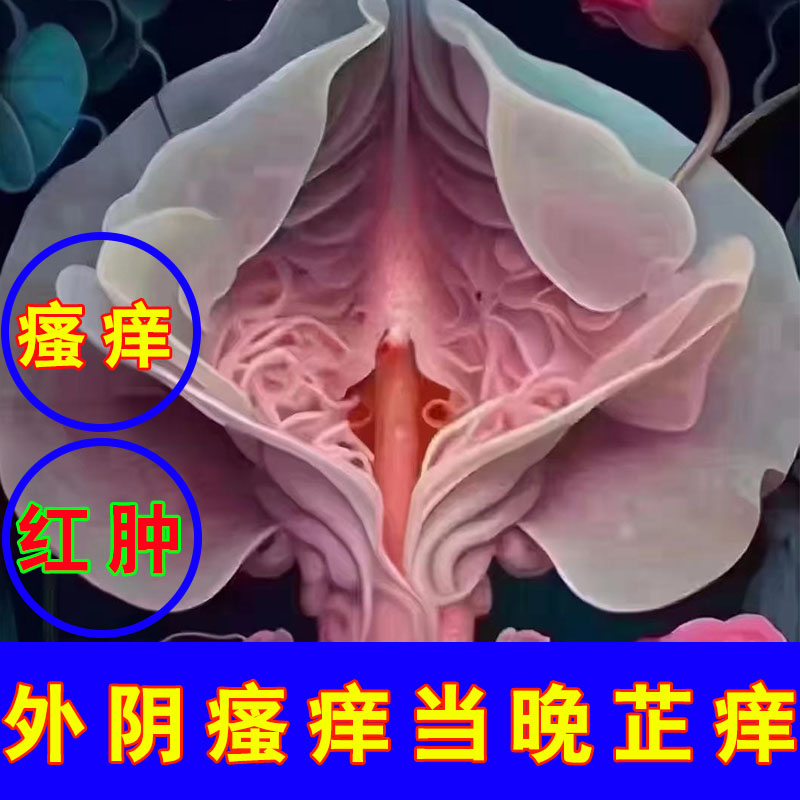 外阴瘙痒芷痒药下边痒死了红肿私处痒异味小疙瘩「当天止痒不再犯
