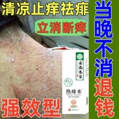 痱子止痒水成人去痱子喷雾液体祛痱膏治除热痱子水大人防菲神器药