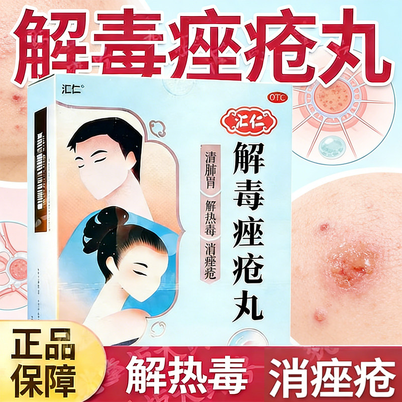 [汇仁]解毒痤疮丸清肺胃解热毒消痤疮祛痘痘皮肤局部粉刺青春痘