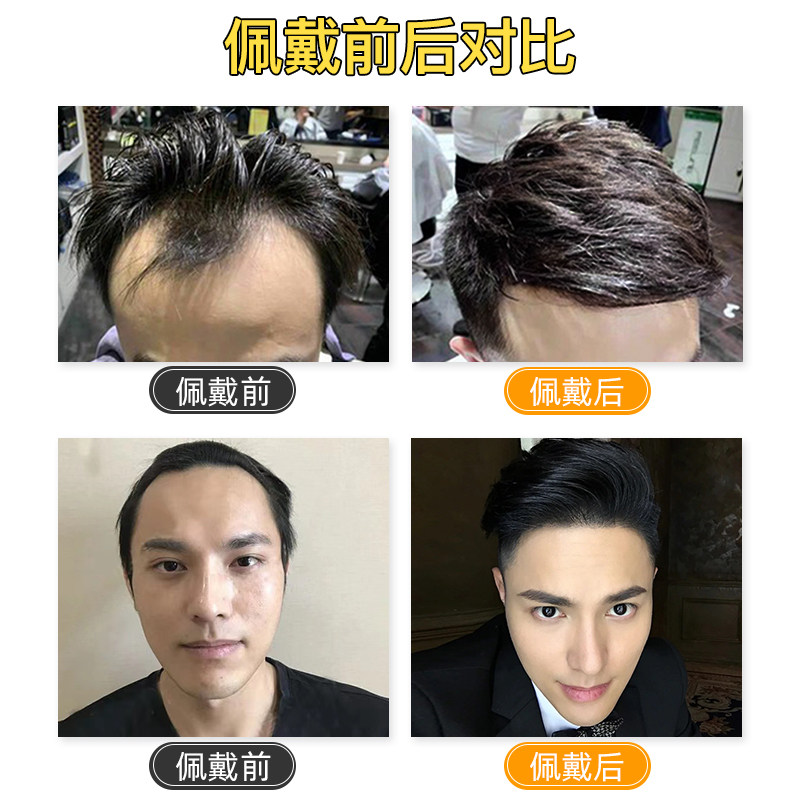发际线假发贴男士前额隐形无痕真发补发片生物头皮m型精修浏海片