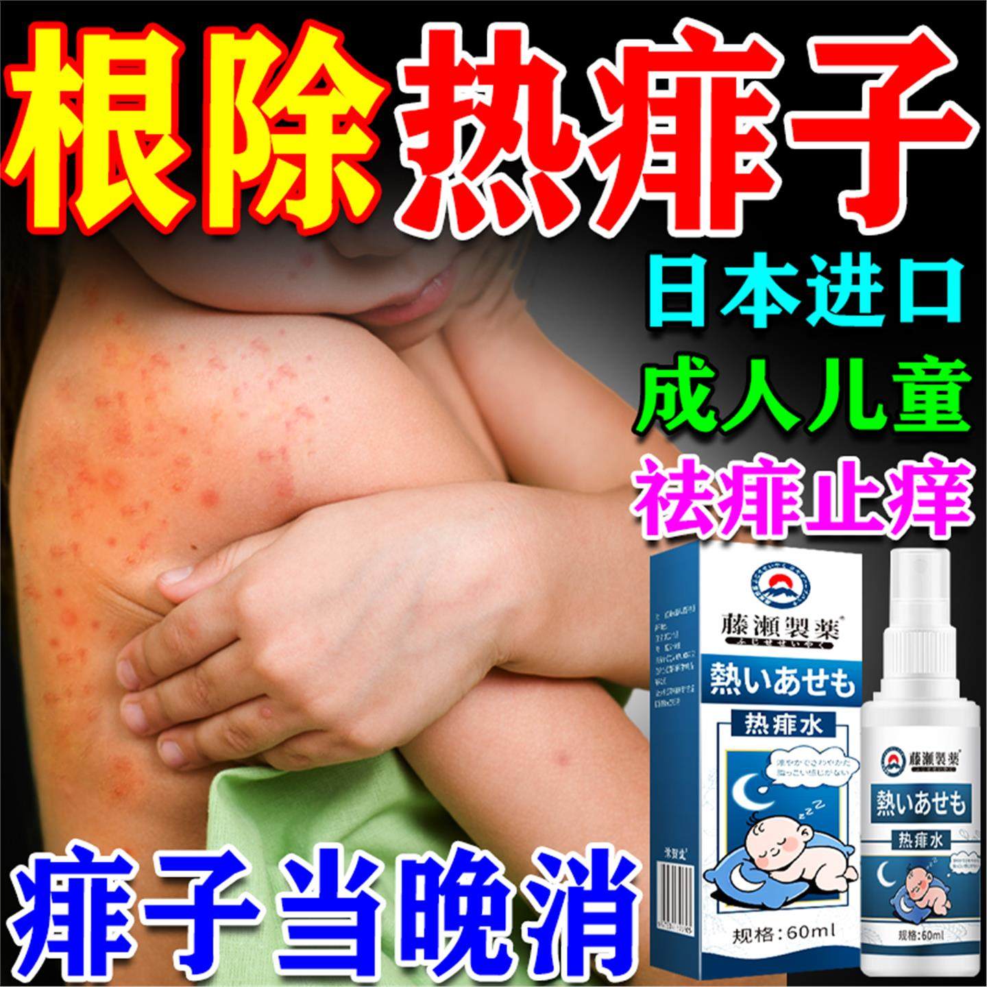 痱子水婴儿专用止痒去痱儿童宝宝淹淹脖子神器洗澡金银花喷雾