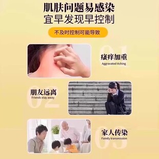 毕大夫皮肤液体敷料皮肤护理软膏皮炎瘙痒官方旗舰店正品MC