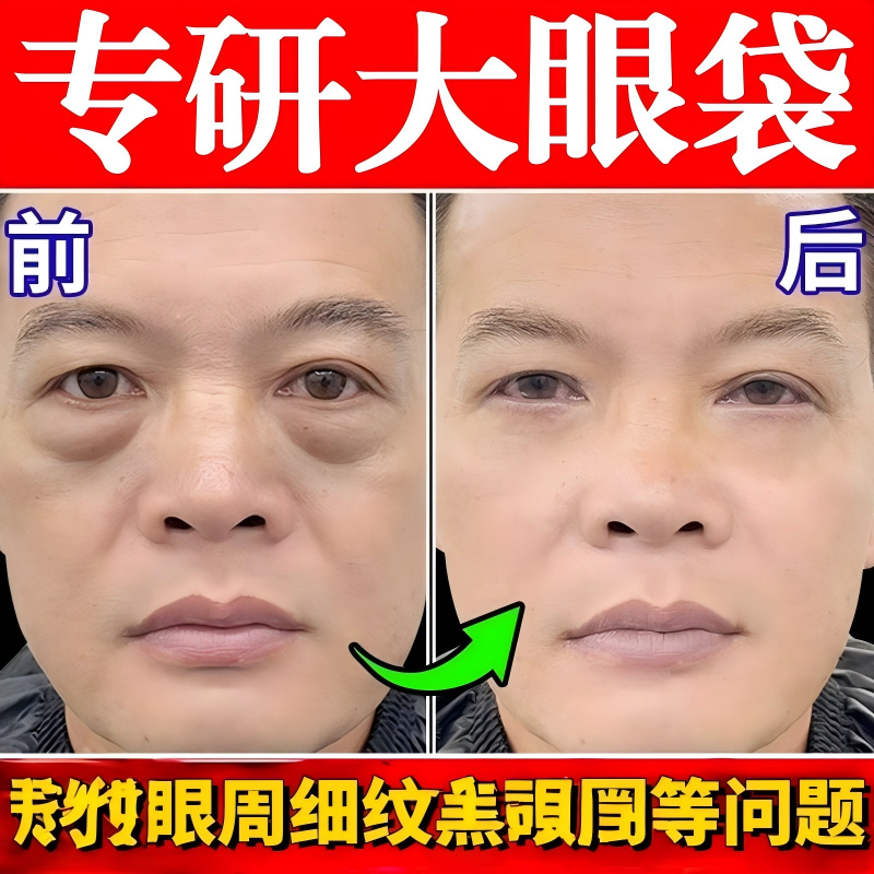 眼袋排肿膏消液严重肿强力去眼消除袋神男士器一分钟克专用霜星