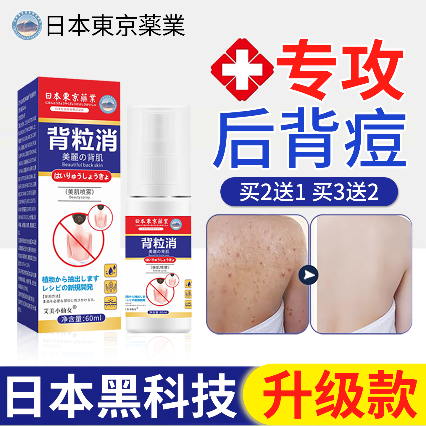 日本背粒消喷雾前胸后背祛痘背后