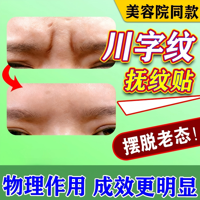 抬头纹女士专用川字纹贴悬针纹图片