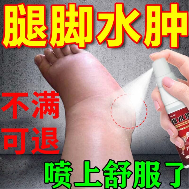 去老人下肢水肿脚肿消肿专用浮肿老人活血化瘀止痛利水利尿排贴膏