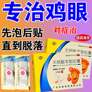 鸡眼贴鸡眼药鸡眼走路疼脚上长鸡眼脚掌鸡眼小趾鸡眼贴膏严重鸡眼