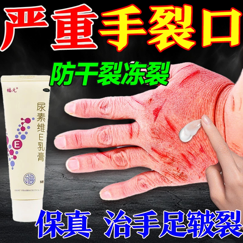 手足干燥起皮脱皮皲裂冻裂冻伤烂止痒专用尿素维e乳膏正品护手霜