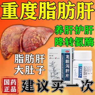 治疗脂肪肝的药辅助降转氨酶药消除脂肪肝特专用药排养肝毒护肝