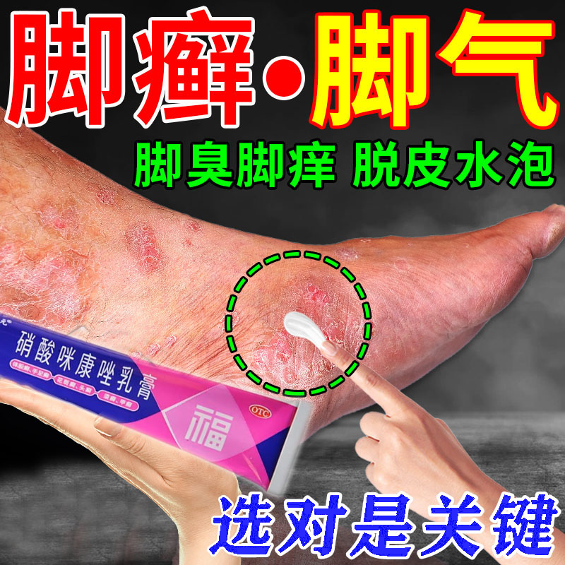 【福元】硝酸咪康唑乳膏2%*20g*1支/盒