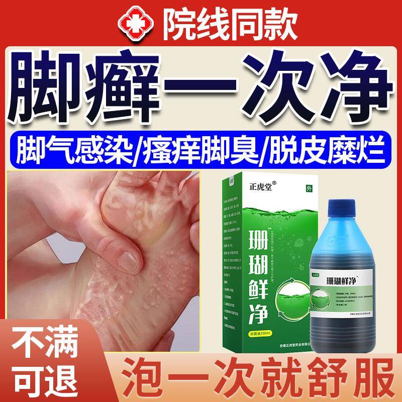 脚藓官方店一次净贵州神奇治疗脚痒脱皮真菌感染水泡型珊瑚鲜净