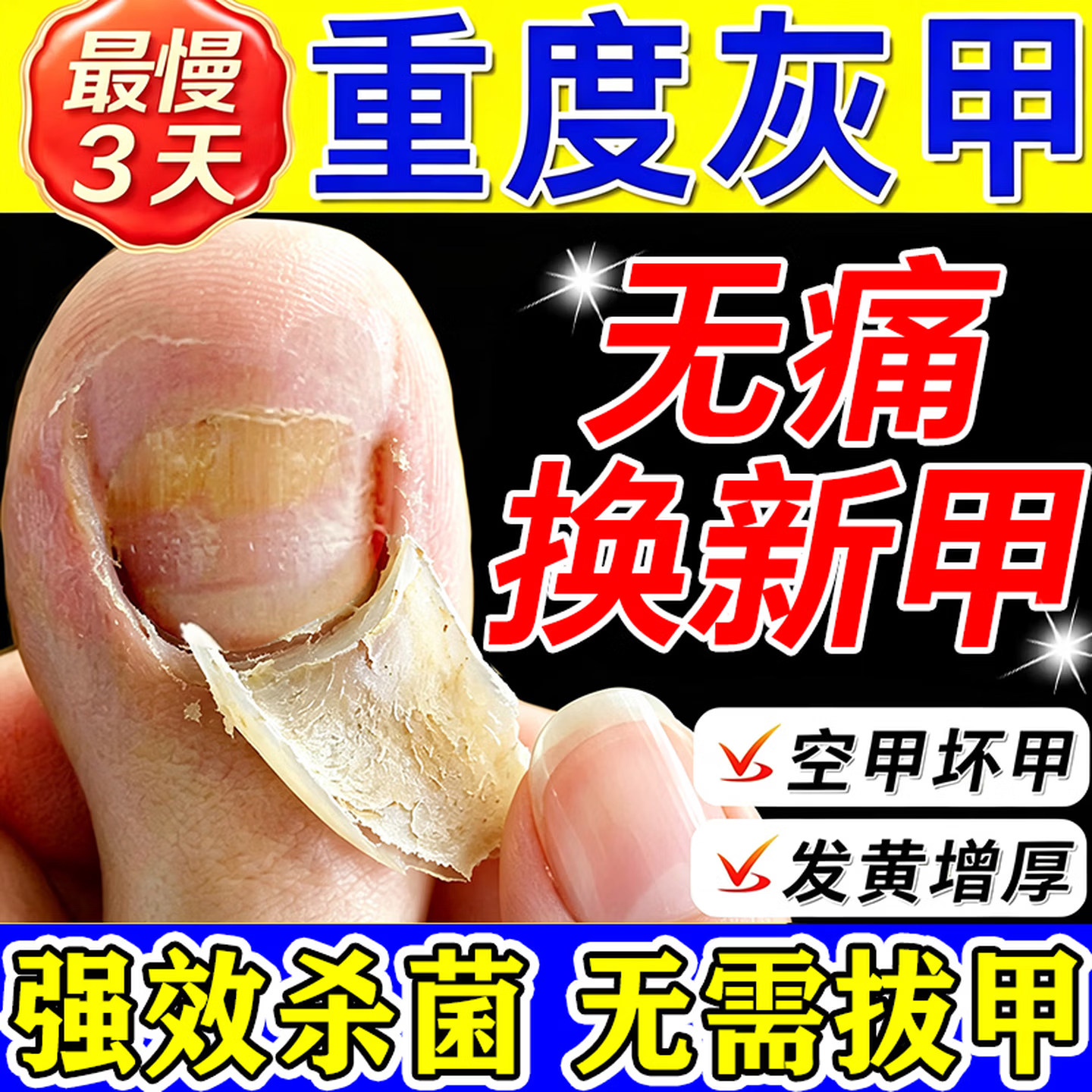灰指甲特药根第一名效正品官方旗舰店治真菌达克宁硝酸咪康唑乳膏