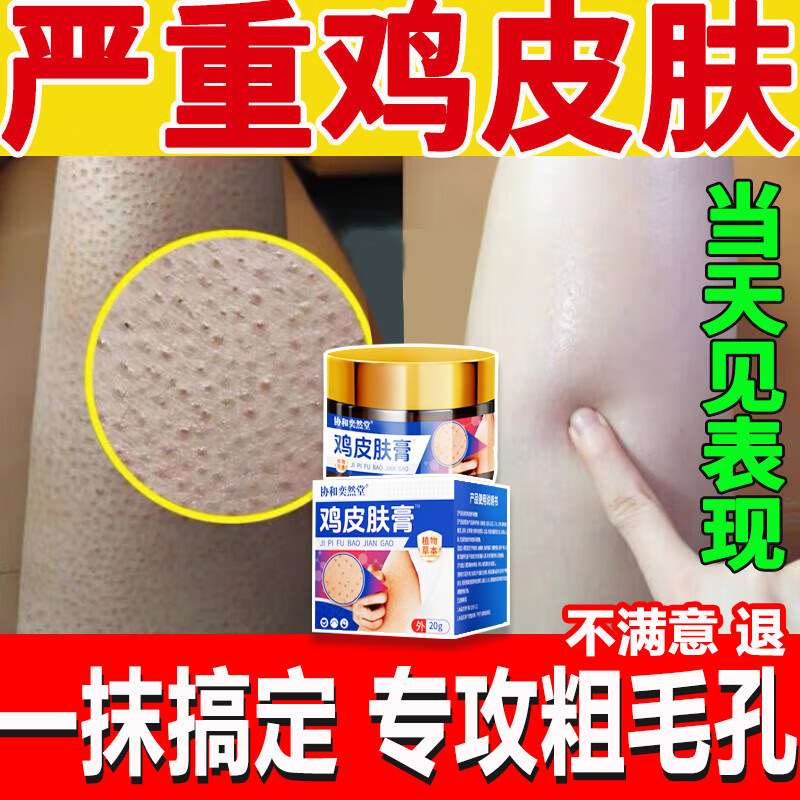 鸡皮肤非去除器瘩神疙毛囊症化角质非果酸身体乳全身手臂胳膊腿qx