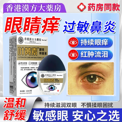 【药房同款】眼睛痒眼药水过敏性