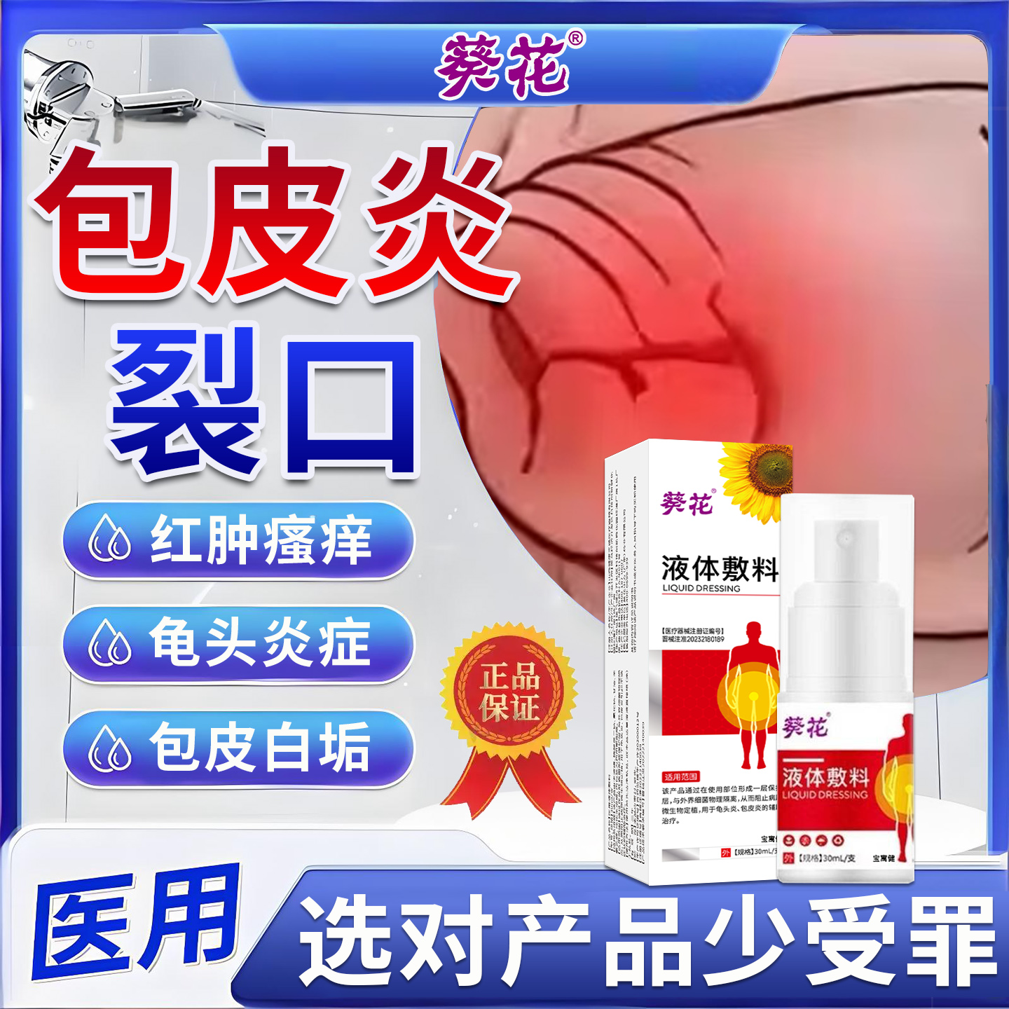 包皮炎裂口龟头炎红肿疼痛皲裂包皮白垢喷剂