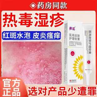 热毒湿疹止痒专用膏除湿皮肤一热就痒湿毒清软膏祛根湿痒皮炎水泡