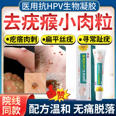 去疣膏斩草除根医用级去猴子肉粒疙瘩肉刺疣瘊子去祛除神器一抹灵