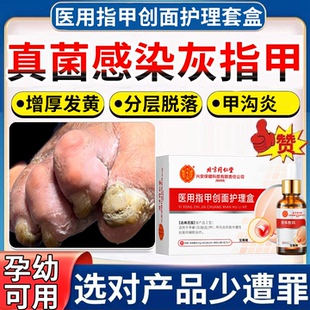 孕妇灰指甲特药水效一滴净脚指甲增厚用什么药变黄灰甲神抑菌液器