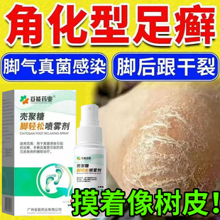 角化型脚癣药膏脚后跟干裂真菌感染角质型脚气一次净官方旗舰店